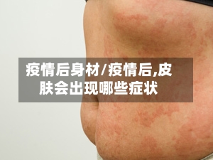 疫情后身材/疫情后,皮肤会出现哪些症状