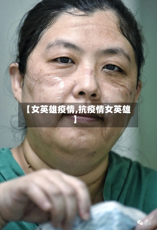 【女英雄疫情,抗疫情女英雄】-第3张图片