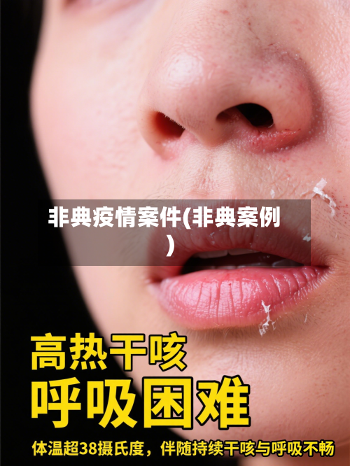 非典疫情案件(非典案例)