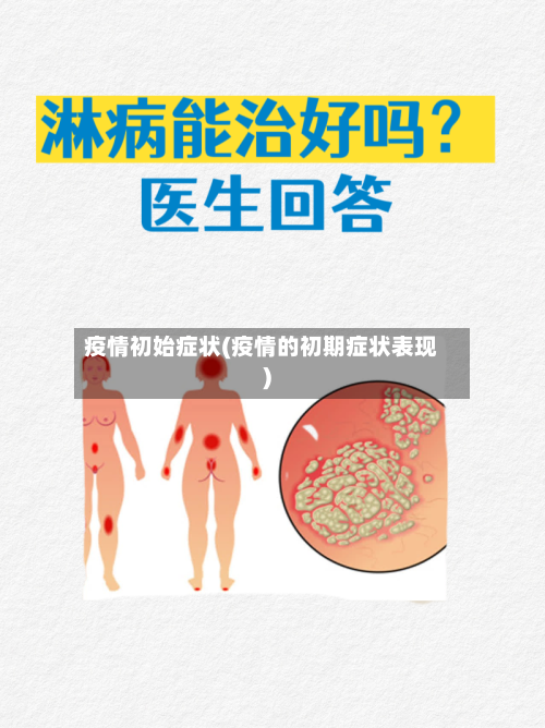 疫情初始症状(疫情的初期症状表现)-第1张图片
