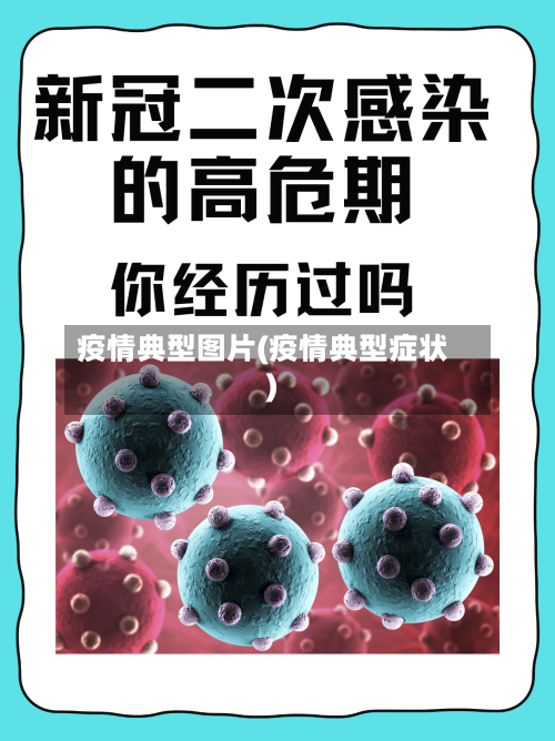 疫情典型图片(疫情典型症状)-第1张图片