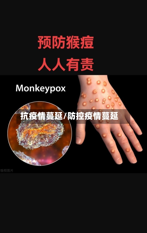 抗疫情蔓延/防控疫情蔓延-第1张图片