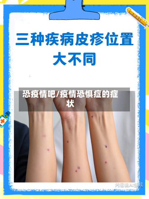 恐疫情吧/疫情恐惧症的症状-第2张图片