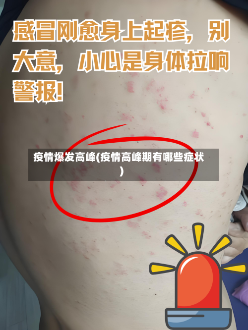 疫情爆发高峰(疫情高峰期有哪些症状)-第2张图片
