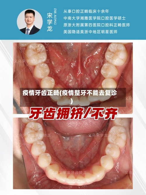 疫情牙齿正畸(疫情整牙不能去复诊)-第2张图片