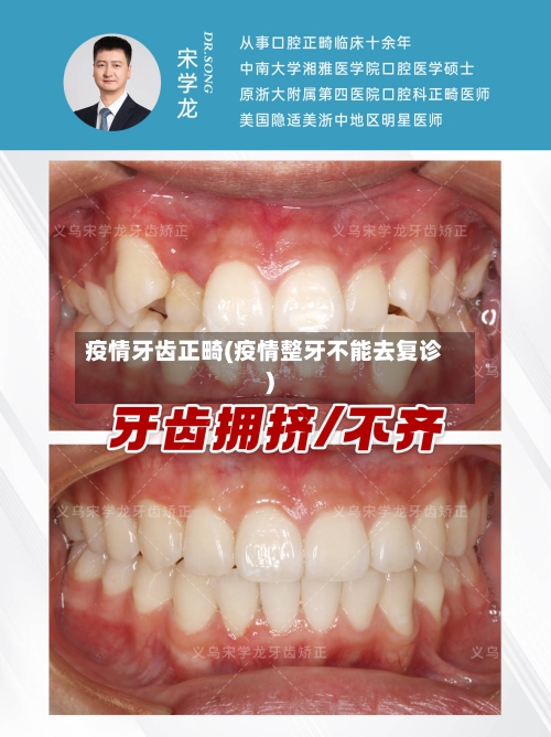 疫情牙齿正畸(疫情整牙不能去复诊)