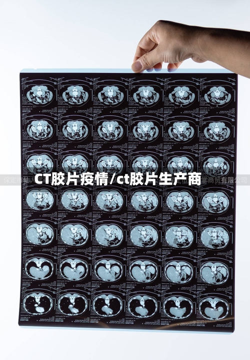 CT胶片疫情/ct胶片生产商