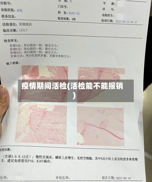 疫情期间活检(活检能不能报销)