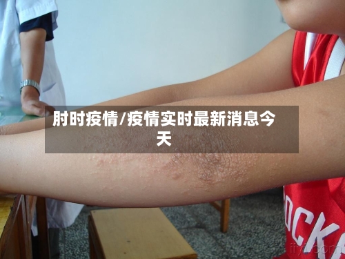 肘时疫情/疫情实时最新消息今天-第1张图片