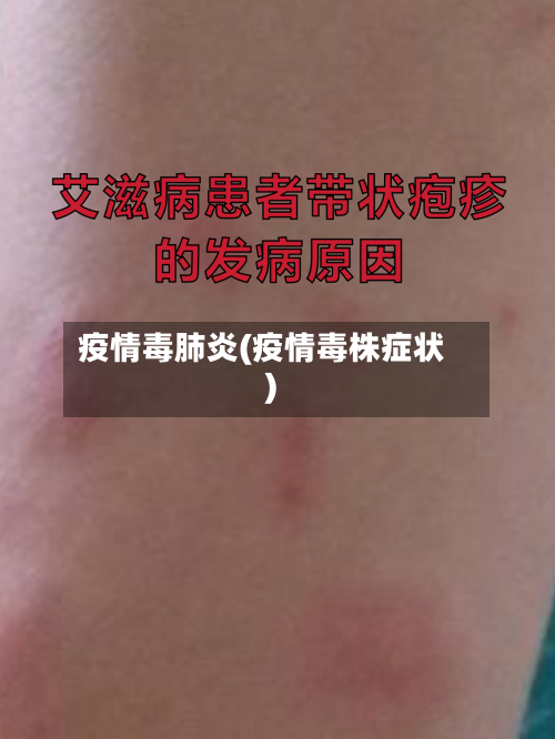 疫情毒肺炎(疫情毒株症状)