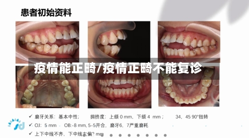 疫情能正畸/疫情正畸不能复诊-第1张图片