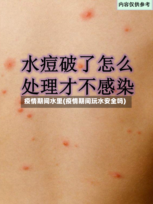 疫情期间水里(疫情期间玩水安全吗)