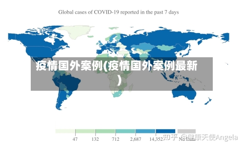 疫情国外案例(疫情国外案例最新)-第2张图片