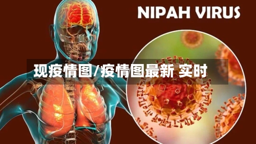 现疫情图/疫情图最新 实时-第1张图片