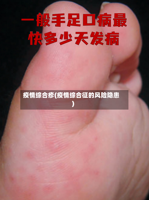 疫情综合疹(疫情综合征的风险隐患)-第2张图片