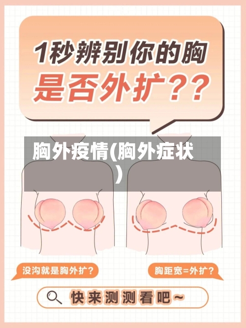 胸外疫情(胸外症状)-第1张图片