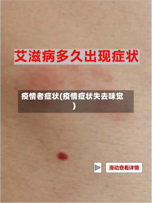 疫情者症状(疫情症状失去味觉)-第1张图片