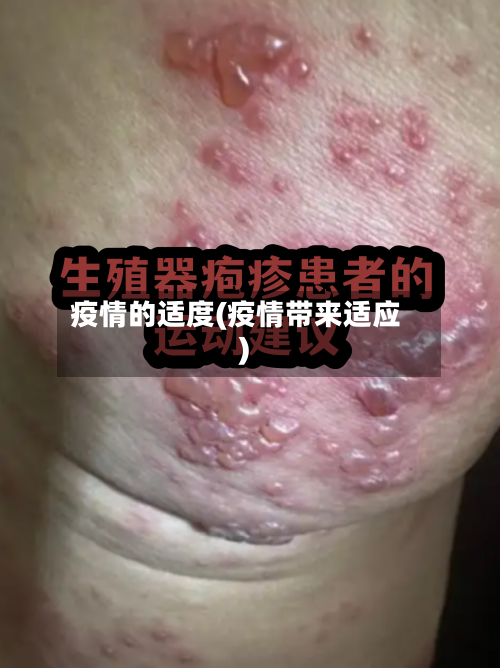 疫情的适度(疫情带来适应)