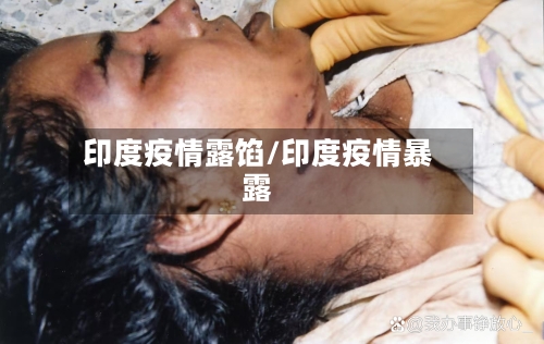 印度疫情露馅/印度疫情暴露