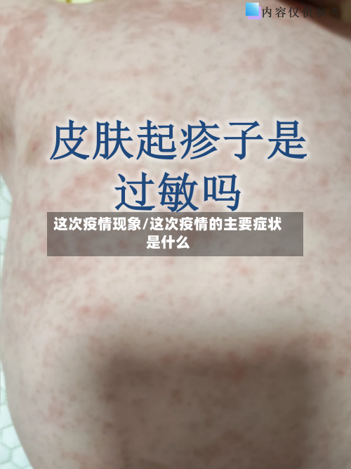 这次疫情现象/这次疫情的主要症状是什么-第1张图片