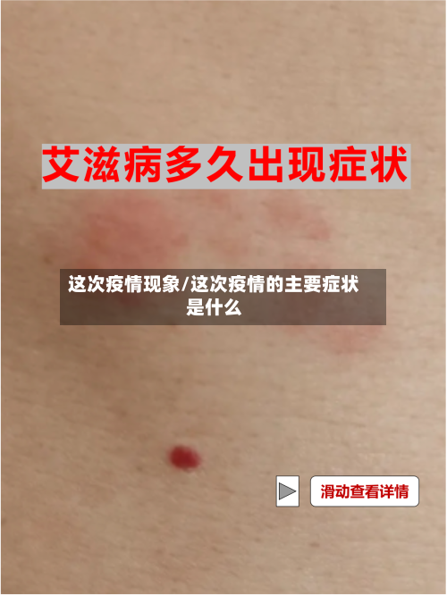 这次疫情现象/这次疫情的主要症状是什么-第3张图片