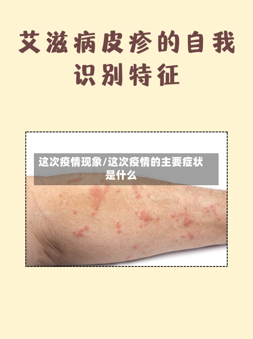 这次疫情现象/这次疫情的主要症状是什么-第2张图片