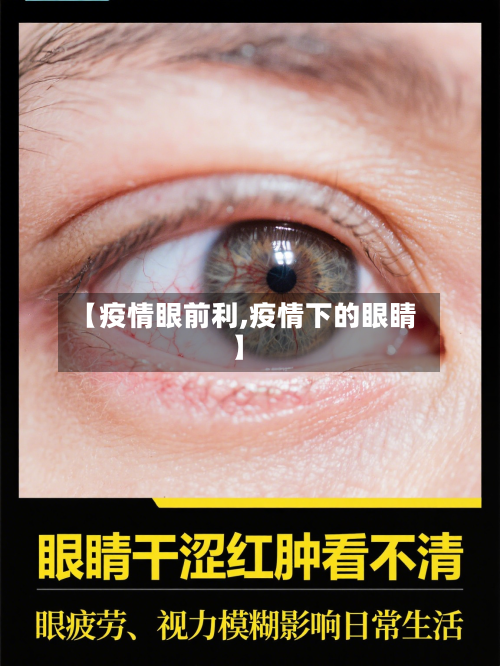 【疫情眼前利,疫情下的眼睛】-第2张图片