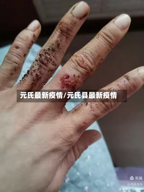 元氏最新疫情/元氏县最新疫情-第1张图片