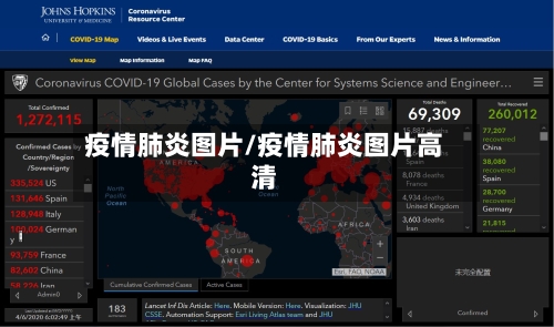 疫情肺炎图片/疫情肺炎图片高清-第2张图片