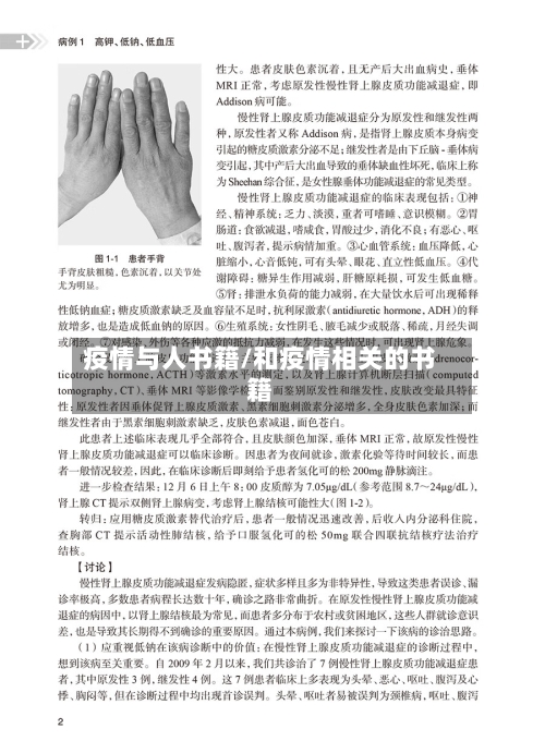 疫情与人书籍/和疫情相关的书籍-第2张图片