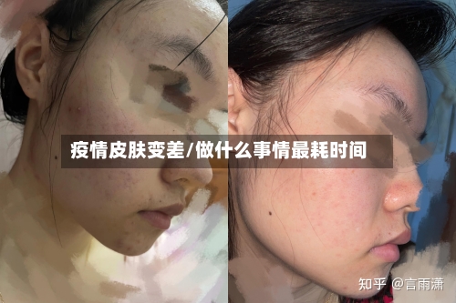 疫情皮肤变差/做什么事情最耗时间-第1张图片