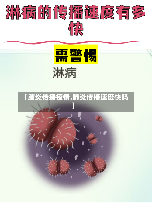 【肺炎传播疫情,肺炎传播速度快吗】-第1张图片