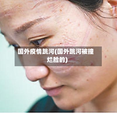 国外疫情跳河(国外跳河被撞烂脸的)-第2张图片