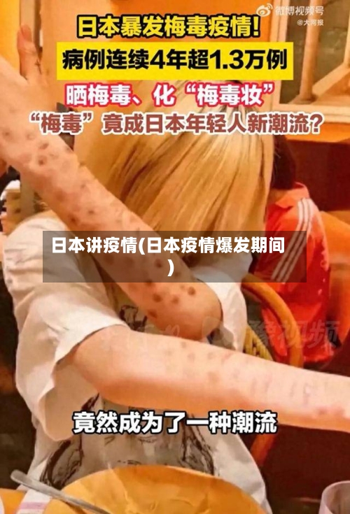 日本讲疫情(日本疫情爆发期间)