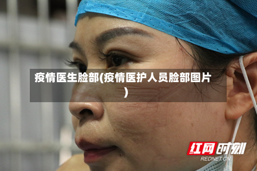 疫情医生脸部(疫情医护人员脸部图片)-第2张图片