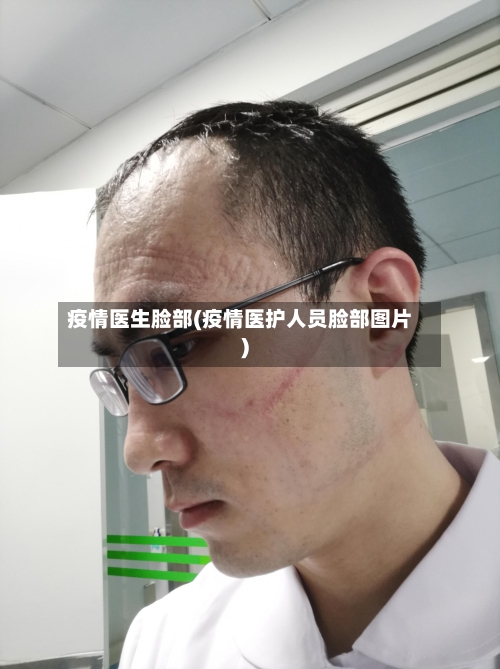 疫情医生脸部(疫情医护人员脸部图片)