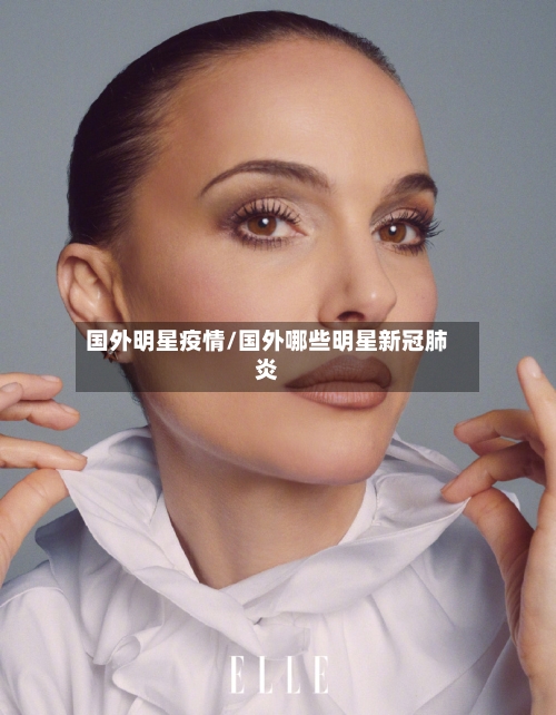 国外明星疫情/国外哪些明星新冠肺炎