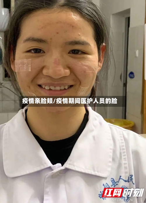 疫情亲脸颊/疫情期间医护人员的脸-第3张图片