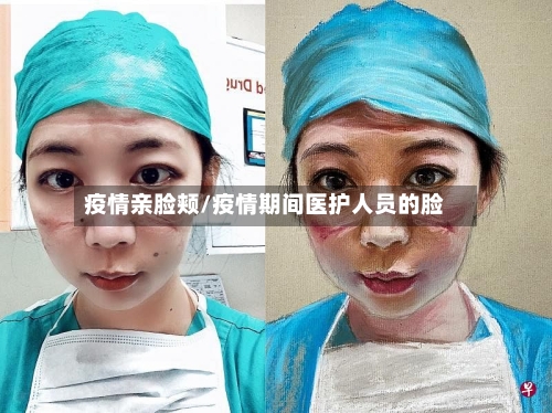 疫情亲脸颊/疫情期间医护人员的脸-第1张图片