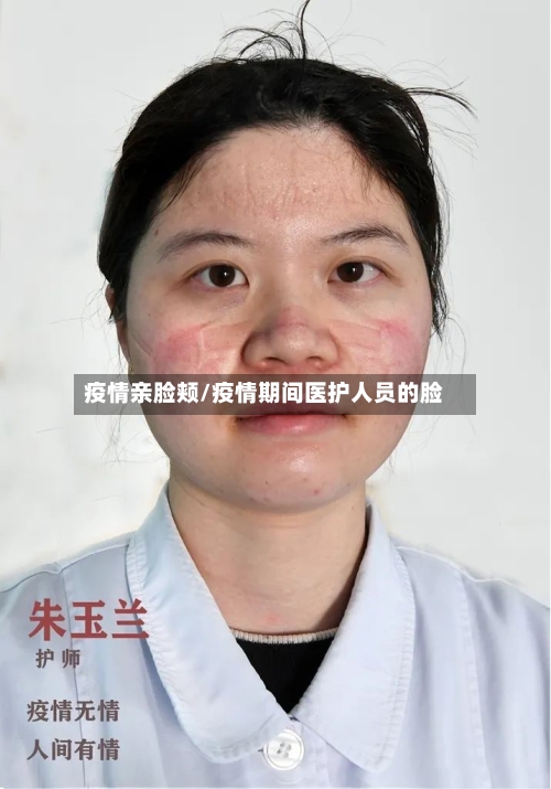 疫情亲脸颊/疫情期间医护人员的脸-第2张图片