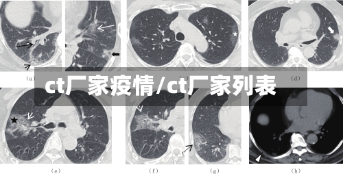 ct厂家疫情/ct厂家列表