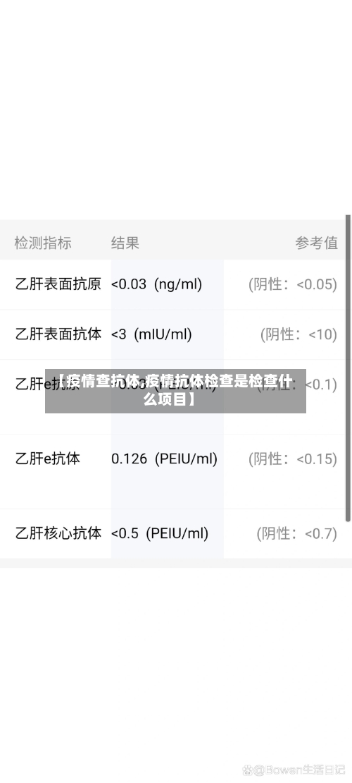 【疫情查抗体,疫情抗体检查是检查什么项目】-第3张图片