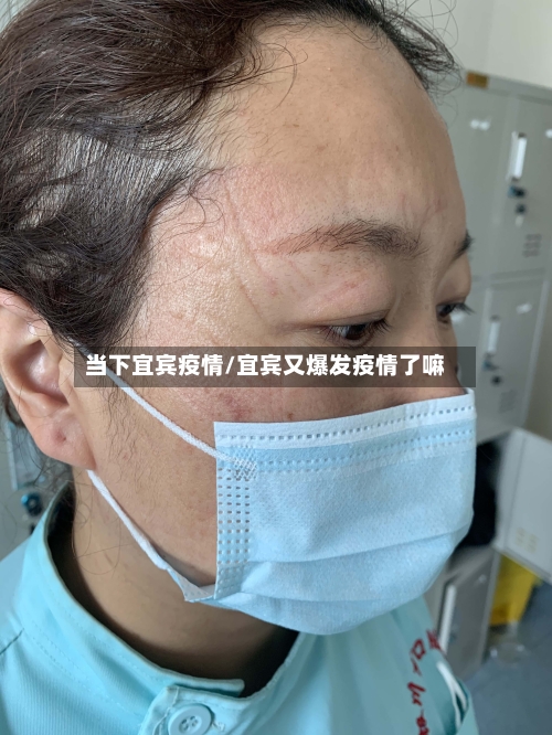 当下宜宾疫情/宜宾又爆发疫情了嘛-第2张图片