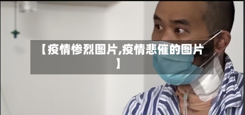 【疫情惨烈图片,疫情悲催的图片】-第1张图片