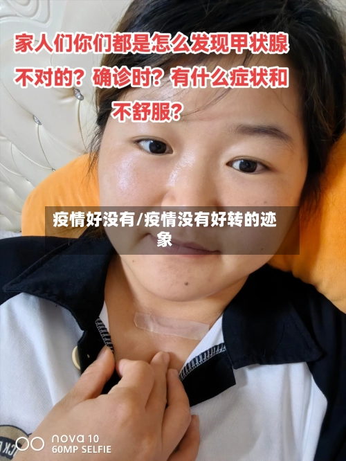 疫情好没有/疫情没有好转的迹象-第1张图片