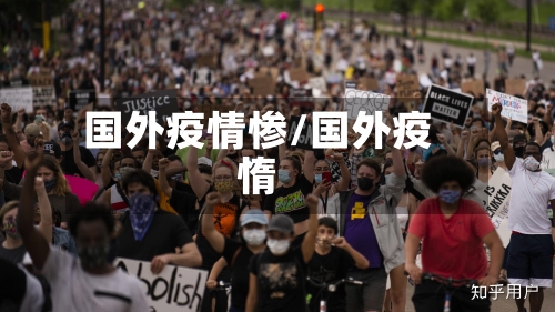 国外疫情惨/国外疫惰-第2张图片