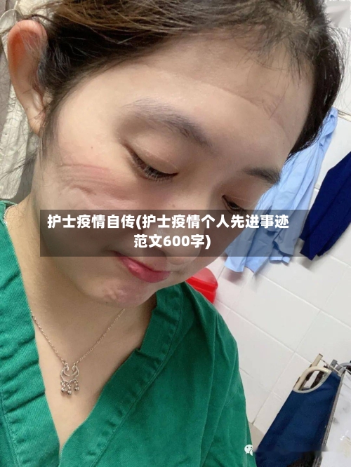 护士疫情自传(护士疫情个人先进事迹范文600字)-第3张图片