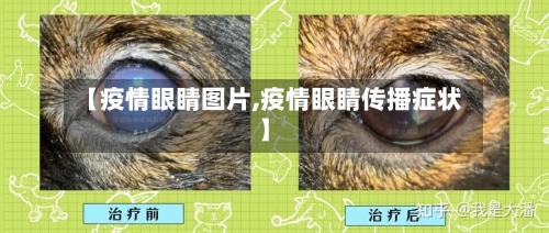 【疫情眼睛图片,疫情眼睛传播症状】-第2张图片