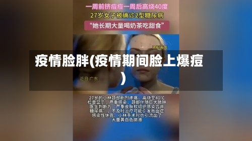 疫情脸胖(疫情期间脸上爆痘)-第2张图片