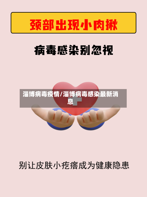 淄博病毒疫情/淄博病毒感染最新消息-第2张图片